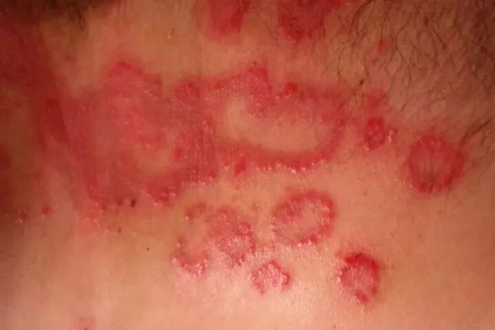 洗手间里的手烘干机和洗手液有细菌吗丨科普