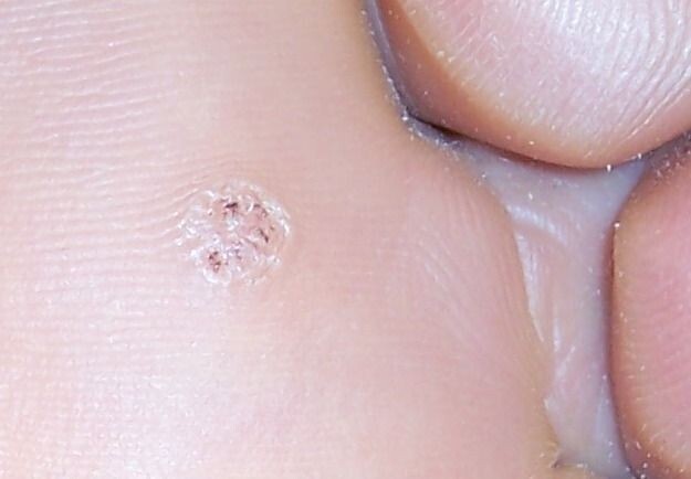 足疗店不用的小鱼最后去了哪儿丨问答