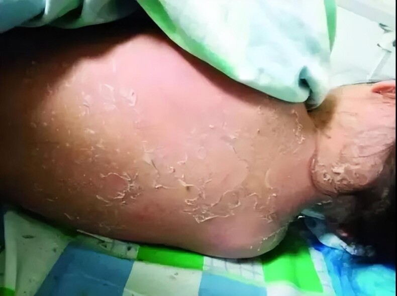 游泳池里的水有多脏？这些数据告诉你真相