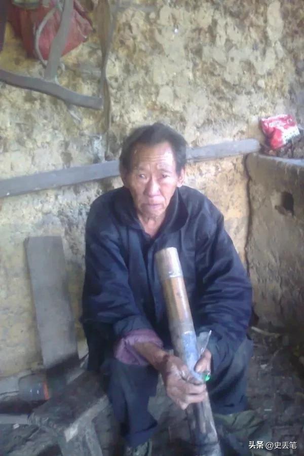 越南有位男人身后长有黑色“尾巴”，每次只要一剪掉就会生病
