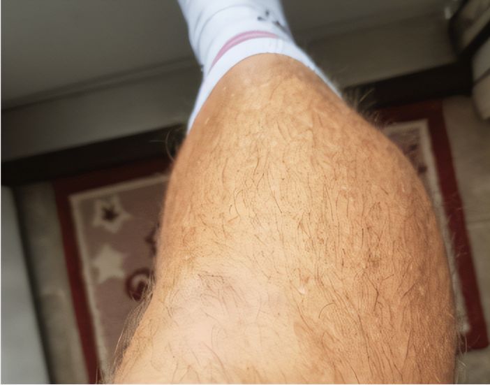 腿毛旺盛的男人说明什么?和性能力有什么关系?
